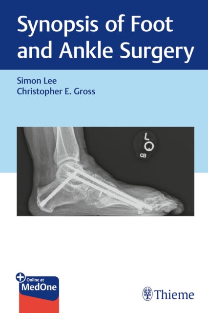 Book cover of: Synopsis of Foot and Ankle Surgery. By: Simon Lee