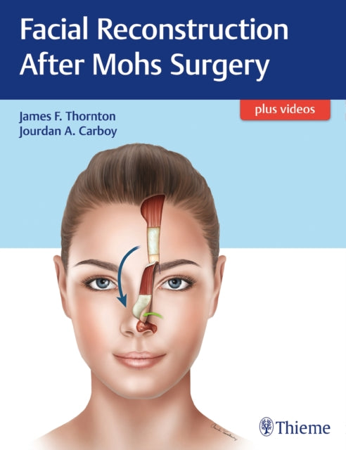 Book cover of: Facial Reconstruction After Mohs Surgery. By: James Thornton