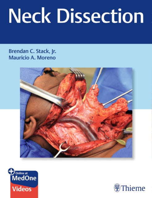 Book cover of: Neck Dissection. By: Brendan Stack  Jr.