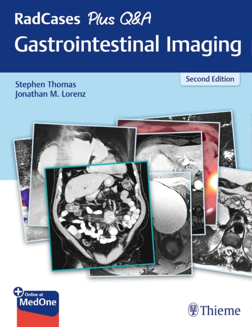 Book cover of: RadCases Plus Q&a Gastrointestinal Imaging. By: Stephen Thomas