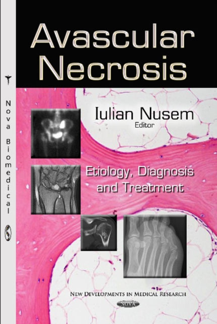 Book cover of: Avascular Necrosis. By: Iulian Nusem