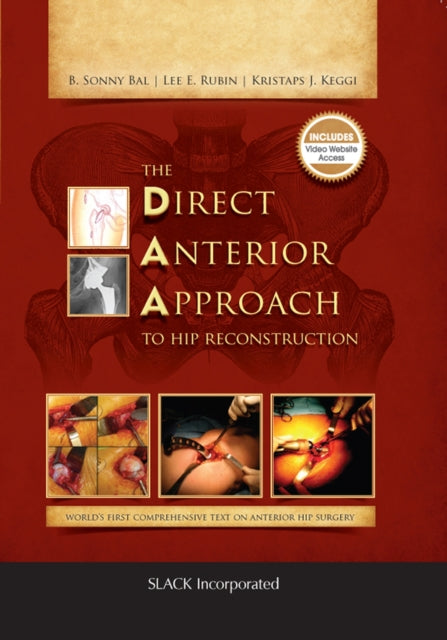 The Direct Anterior Approach to Hip Reconstruction