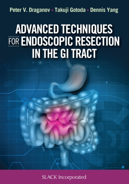 Book cover of: Advanced Techniques for Endoscopic Resection in the GI Tract. By: Peter Vassilev Draganov