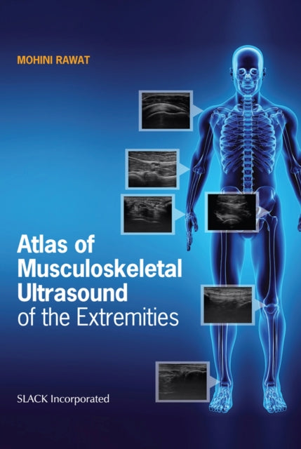 Atlas of Musculoskeletal Ultrasound of the Extremities