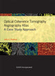 Book cover of: Optical Coherence Tomography Angiography Atlas. By: Julie A. Rodman