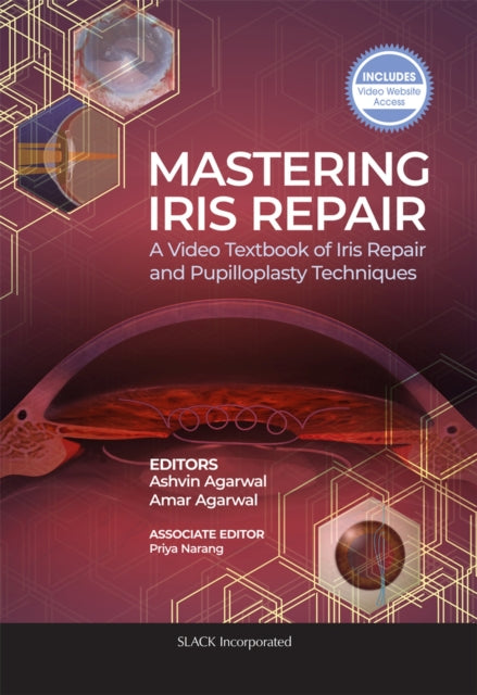 Book cover of: Mastering Iris Repair. By: Ashvin Agarwal