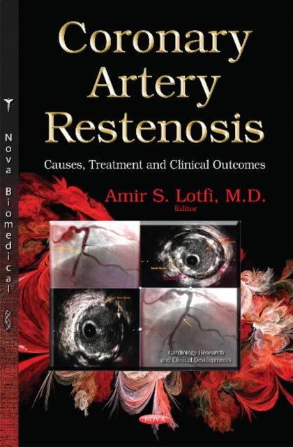 Book cover of: Coronary Artery Restenosis. By: Amir S. Lotfi