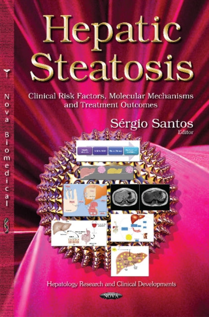 Book cover of: Hepatic Steatosis. By: Sergio Santos