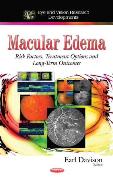 Macular Edema