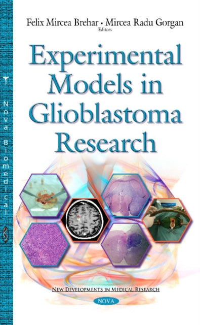 Book cover of: Experimental Models in Glioblastoma Research. By: Felix Mircea Brehar