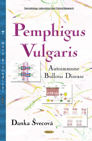 Pemphigus Vulgaris