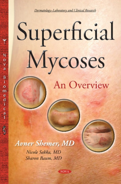 Book cover of: Superficial Mycoses. By: Avner Shemer