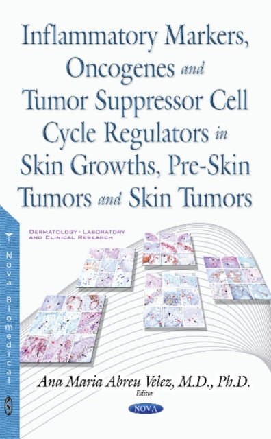 Book cover of: Inflammatory Markers, Oncogenes, Tumor Suppressor Cell Cycle Regulators in Skin Growths, Pre-Skin Tumors & Skin Tumors. By: Ana Maria Abreu Velez