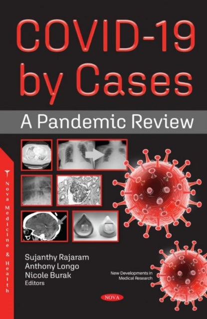 Book cover of: COVID-19 by Cases. By: Sujanthy Rajaram