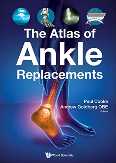 Book cover of: Atlas Of Ankle Replacements, The. By: Paul Cooke