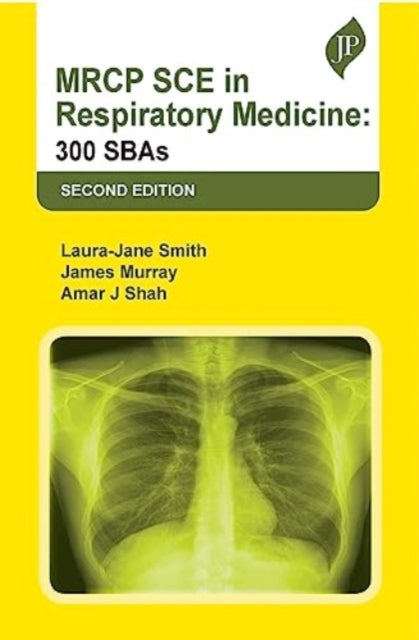 Book cover of: MRCP SCE in Respiratory Medicine. By: Laura Jane Smith