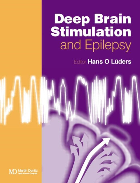 Deep Brain Stimulation and Epilepsy