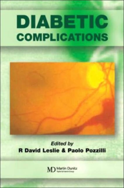 Book cover of: Diabetic Complications