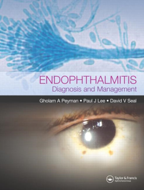 Book cover of: Endophthalmitis