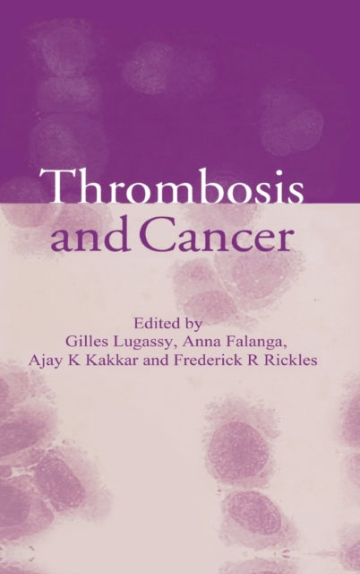 Book cover of: Thrombosis and Cancer