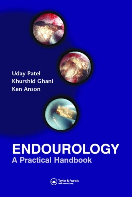 Book cover of: Endourology