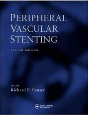 Peripheral Vascular Stenting, Second Edition