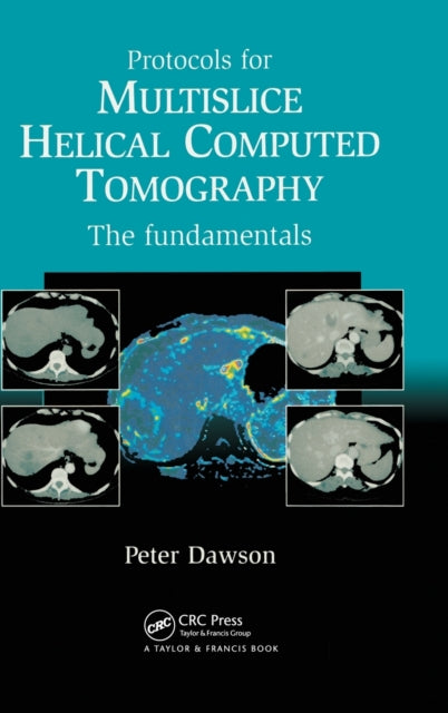 Protocols for Multislice Helical Computed Tomography