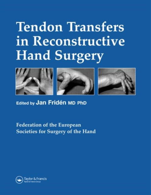 Book cover of: Tendon Transfers in Reconstructive Hand Surgery. By: Jan Friden