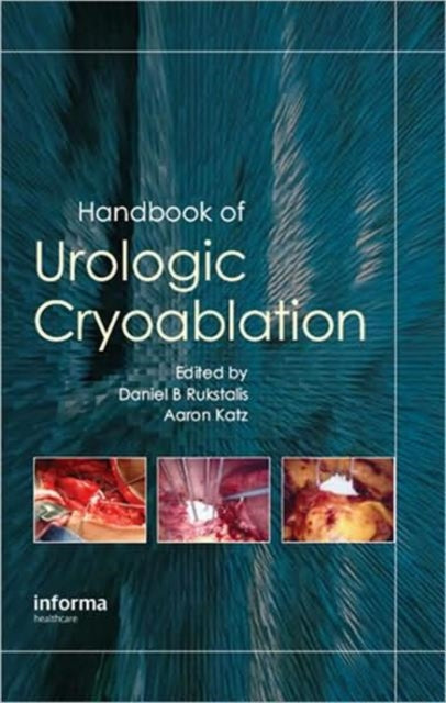 Book cover of: Handbook of Urologic Cryoablation
