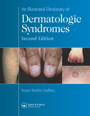 An Illustrated Dictionary of Dermatologic Syndromes