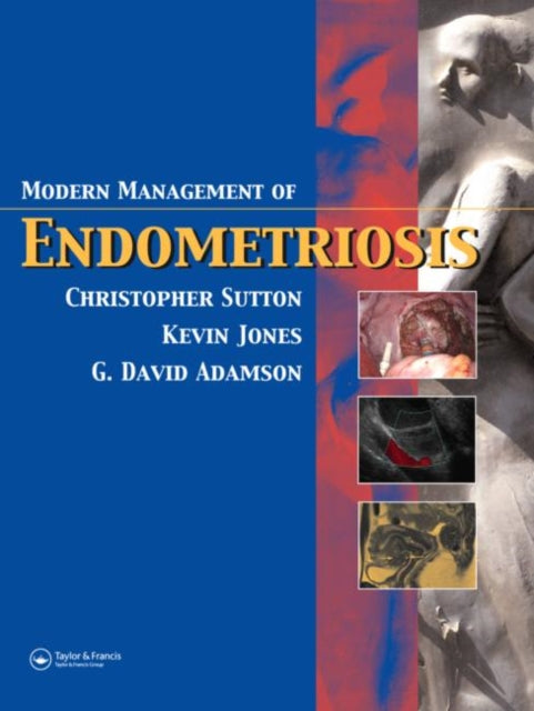 Book cover of: Modern Management of Endometriosis