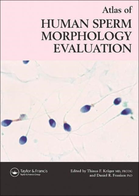 Book cover of: Atlas of Human Sperm Morphology Evaluation