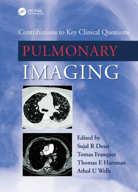 Book cover of: Pulmonary Imaging. By: Sujal Desai