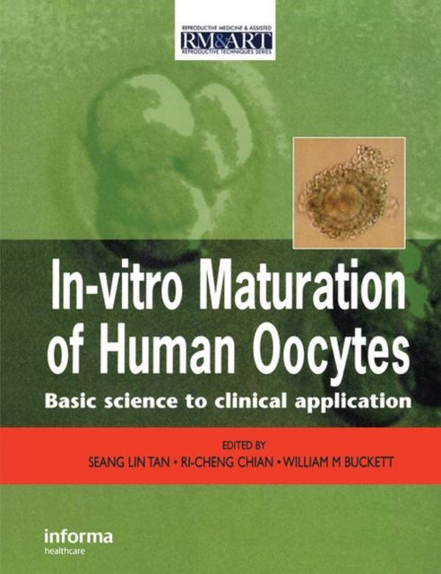 Book cover of: In Vitro Maturation of Human Oocytes