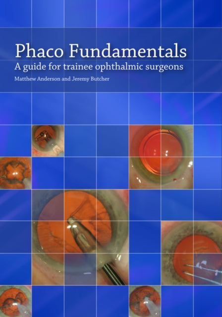 Book cover of: Phaco Fundamentals. By: Matthew Anderson