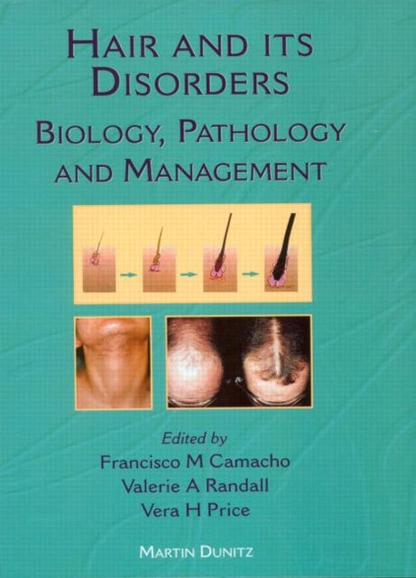 Book cover of: Hair and Its Disorders. By: Francisco M Camacho