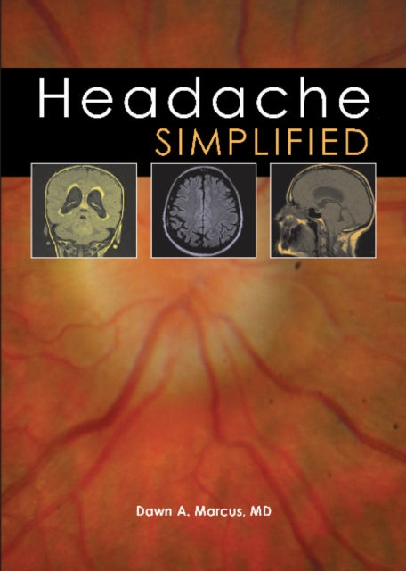 Book cover of: Headache Simplified