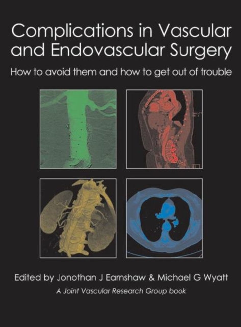 Book cover of: Complications in Vascular and Endovascular Surgery. By: J. J. Earnshaw