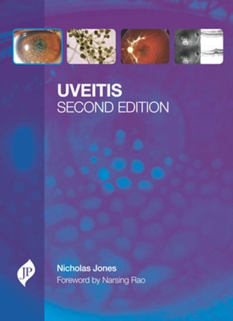 Book cover of: Uveitis. By: Nicholas P. Jones