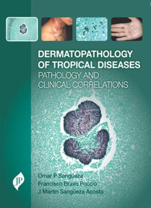Dermatopathology of Tropical Diseases