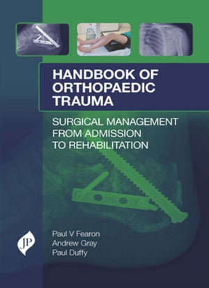 Handbook of Orthopaedic Trauma