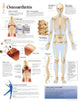 Book cover of: Osteoarthritis Paper Poster