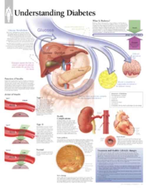 Book cover of: Understanding Diabetes Laminated Poster. By: Scientific Publishing