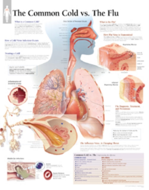 Book cover of: Understanding the Common Cold Laminated Poster