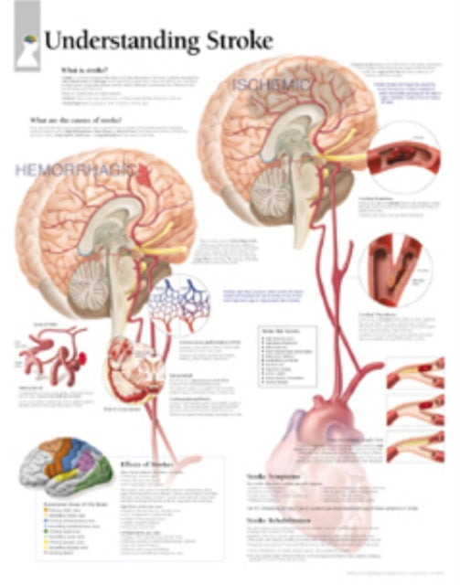 Book cover of: Understanding Stroke Paper Poster. By: Scientific Publishing