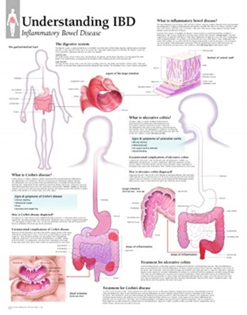 Book cover of: Understanding IBD. By: Scientific Publishing Ltd.
