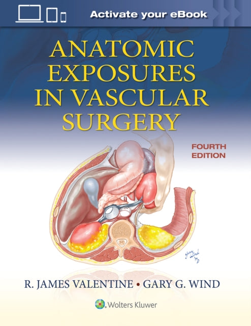 Book cover of: Anatomic Exposures in Vascular Surgery. By: Wind, Gary, G.