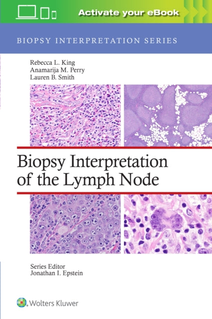 Book cover of: Biopsy Interpretation of the Lymph Node: Print + eBook with Multimedia. By: Rebecca L. King