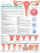 Book cover of: Understanding Cervical Cancer Anatomical Chart