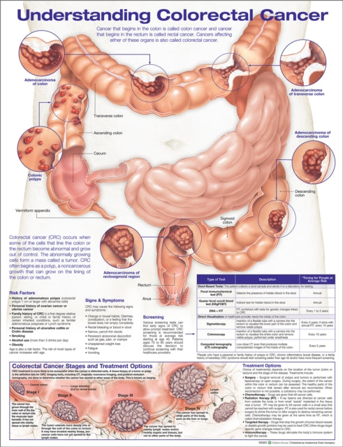 Book cover of: Understanding Colorectal  Cancer Anatomical Chart